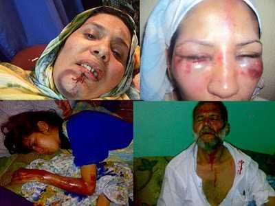 Imagenes del estado de los activistas saharauis