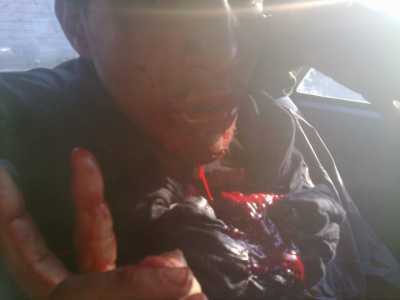 La imagen es de un saharaui agredido por la policia marroquí | SaharaThawra