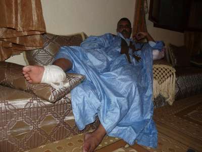 Sidahmed Lemjiyed: contusión en un pie con posterior inflamación.
